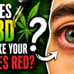 Close-up of a red eye beside a CBD oil bottle with bold text asking “Does CBD Make Your Eyes Red?” in a high-contrast featured image.